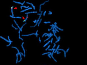 Hibridación Fluorescente In Situ (Fish)